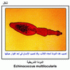 ������ �������� Echinococcus multilocularis