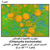 ������ �������� ��������� (Chlamydia trachomatis)� ������ ���� ����� ������� ��������� ��������